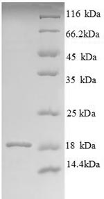 Greater than 90% as determined by SDS-PAGE.Recombinant Bovine Angiogenin-1 (ANG1) Protein (His)