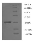 Greater than 90% as determined by SDS-PAGE.Recombinant Human Hla Class Ii Histocompatibility Antigen, Dp Beta 1 Chain (HLA-DPB1) Protein (His)