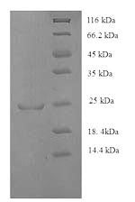 Greater than 90% as determined by SDS-PAGE.Recombinant Human Hla Class Ii Histocompatibility Antigen, Dq Alpha 1 Chain (HLA-DQA1) Protein (His)