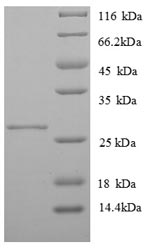 Greater than 90% as determined by SDS-PAGE.Recombinant Human Mhc Class Ii Antigen (HLA-DQB1) Protein (His)