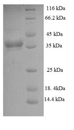 Greater than 90% as determined by SDS-PAGE.Recombinant Mycobacterium Tuberculosis Phosphate-Binding Protein Psts 1 (PSTS1) Protein (His)