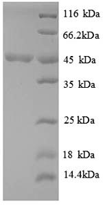 Greater than 90% as determined by SDS-PAGE.Recombinant Sporosarcina Ureae Phenylalanine Dehydrogenase (PDH) Protein (His)