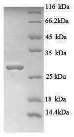 Greater than 90% as determined by SDS-PAGE.Recombinant Human Titin (TTN) Protein (His)