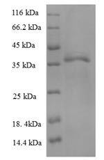 Greater than 90% as determined by SDS-PAGE.Recombinant Human Hla-B Protein (HLA-B) Protein (His)