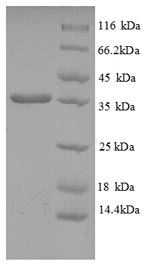 Greater than 90% as determined by SDS-PAGE.Recombinant Human Hla-C Protein (HLA-C) Protein (His)