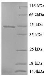 Greater than 90% as determined by SDS-PAGE.Recombinant Chicken Uncharacterized Protein (DCX) Protein (His)