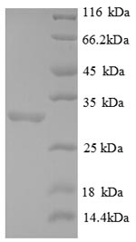 Greater than 90% as determined by SDS-PAGE.Recombinant Human Forkhead Box Protein P3 (FOXP3) Protein (His)