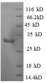 Greater than 90% as determined by SDS-PAGE.Recombinant Human Mitogen-Activated Protein Kinase 1 (MAP3K1) Protein (His)