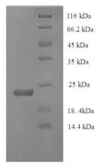 Greater than 90% as determined by SDS-PAGE.Recombinant Human Caspase-7 (CASP7) Protein (His)