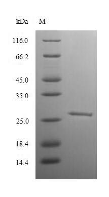 Greater than 90% as determined by SDS-PAGE.Recombinant Rat Retinoblastoma-Associated Protein (RB1) Protein (His)