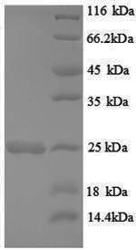 Greater than 90% as determined by SDS-PAGE.Recombinant Rat Gtpase Hras (HRAS) Protein (His)