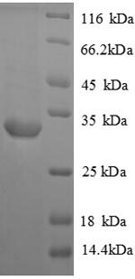 Greater than 90% as determined by SDS-PAGE.Recombinant Rat Vasopressin V1A Receptor (AVPR1A) Protein (GST)