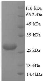 Greater than 90% as determined by SDS-PAGE.Recombinant Human Hypoxanthine-Guanine Phosphoribosyltransferase (HPRT1) Protein (His)