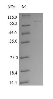 Greater than 90% as determined by SDS-PAGE.Recombinant Human Rac-Alpha Serine/Threonine-Protein Kinase (AKT1) Protein (GST)