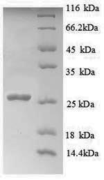 Greater than 90% as determined by SDS-PAGE.Recombinant Human Myelin Transcription Factor 1 (MYT1) Protein (His)