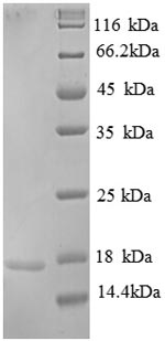 Greater than 90% as determined by SDS-PAGE.Recombinant Human Replication Protein A 14 Kda Subunit (RPA3) Protein (His)