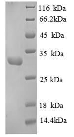 Greater than 90% as determined by SDS-PAGE.Recombinant Human Replication Protein A 30 Kda Subunit (RPA4) Protein (His)