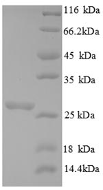 Greater than 90% as determined by SDS-PAGE.Recombinant Saccharomyces Cerevisiae Chitin Synthase 1 (CHS1) Protein (His)