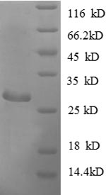 Greater than 90% as determined by SDS-PAGE.Recombinant E.Coli Adenylate Kinase (ADK) Protein (His)