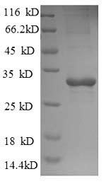 Greater than 90% as determined by SDS-PAGE.Recombinant Saccharomyces Cerevisiae Trehalose-Phosphatase (TPS2) Protein (His)