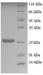 Greater than 90% as determined by SDS-PAGE.Recombinant Saccharomyces Cerevisiae Trehalose-Phosphatase (TPS2) Protein (His)