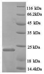 Greater than 90% as determined by SDS-PAGE.Recombinant Rat Nitric Oxide Synthase, Endothelial (NOS3) Protein (His)