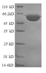 Greater than 90% as determined by SDS-PAGE.Recombinant Human Mitochondrial Peptide Methionine Sulfoxide Reductase (MSRA) Protein (GST)