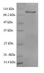 Greater than 90% as determined by SDS-PAGE.Recombinant Rat Vascular Cell Adhesion Protein 1 (VCAM1) Protein (His)