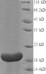 Greater than 90% as determined by SDS-PAGE.Recombinant Human Interleukin-18-Binding Protein (IL18BP) Protein (His)