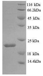 Greater than 90% as determined by SDS-PAGE.Recombinant Mouse Interleukin-18-Binding Protein (IL18BP) Protein (His)