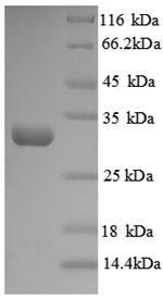 Greater than 90% as determined by SDS-PAGE.Recombinant Human Protein-Lysine 6-Oxidase (LOX) Protein (His)