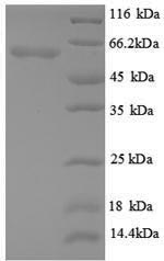 Greater than 90% as determined by SDS-PAGE.Recombinant Mouse Angiopoietin-2 (ANGPT2) Protein (His)