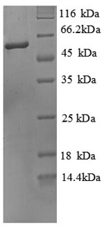 Greater than 90% as determined by SDS-PAGE.Recombinant Mouse Alkaline Phosphatase, Tissue-Nonspecific Isozyme (ALPL) Protein (His)