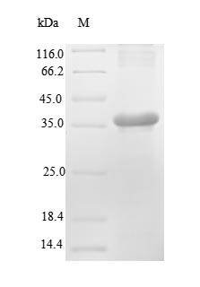 Greater than 90% as determined by SDS-PAGE.Recombinant Mouse Renin-2 (REN2) Protein (His)