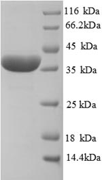 Greater than 90% as determined by SDS-PAGE.Recombinant Rat Haptoglobin (HP) Protein (His)