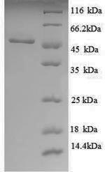 Greater than 90% as determined by SDS-PAGE.Recombinant E.Coli Udp-Glucose 6-Dehydrogenase (UGD) Protein (His)