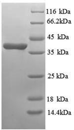 Greater than 90% as determined by SDS-PAGE.Recombinant Human Annexin A3 (ANXA3) Protein (His)