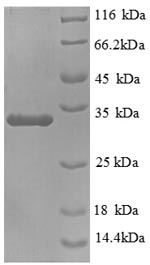 Greater than 90% as determined by SDS-PAGE.Recombinant Mouse Mucin 5, Subtypes A And C, Tracheobronchial/Gastric (MUC5AC) Protein (His)