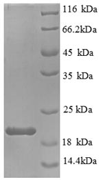 Greater than 90% as determined by SDS-PAGE.Recombinant Mouse Interleukin-1 Beta (IL1B) Protein (His)
