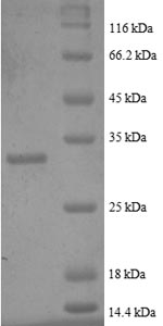 Greater than 90% as determined by SDS-PAGE.Recombinant Human Metallothionein-2 (MT2A) Protein (GST)