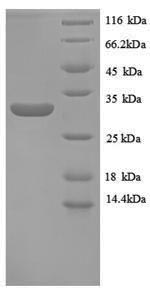 Greater than 90% as determined by SDS-PAGE.Recombinant Human Metallothionein-1E (MT1E) Protein (GST)