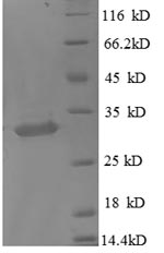 Greater than 90% as determined by SDS-PAGE.Recombinant Human Metallothionein-1X (MT1X) Protein (GST)