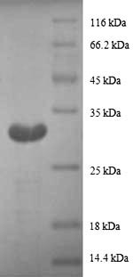 Greater than 90% as determined by SDS-PAGE.Recombinant Human Metallothionein-1G (MT1G) Protein (GST)