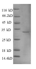 Greater than 90% as determined by SDS-PAGE.Recombinant Human Metallothionein-1A (MT1A) Protein (GST)