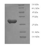 Greater than 90% as determined by SDS-PAGE.Recombinant Human Asialoglycoprotein Receptor 1 (ASGR1) Protein (His)