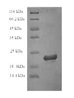 Greater than 90% as determined by SDS-PAGE.Recombinant Rat Interleukin-18 (IL18) Protein (His)
