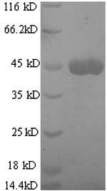 Greater than 90% as determined by SDS-PAGE.Recombinant Mouse Collagenase 3 (MMP13) Protein (His)