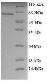 Greater than 90% as determined by SDS-PAGE.Recombinant Human Histone Acetyltransferase Kat5 (KAT5) Protein (His)