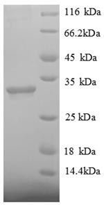 Greater than 90% as determined by SDS-PAGE.Recombinant Human Histone Deacetylase 7 (HDAC7) Protein (His)