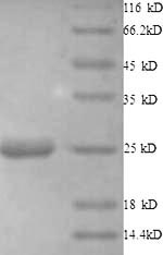 Greater than 90% as determined by SDS-PAGE.Recombinant Human Histone Deacetylase 7 (HDAC7) Protein (His)